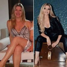 Luisa sonza antes e depois. Mae Gata De Luisa Sonza Impressiona Com Fotos Antes E Depois De Harmonizacao Facial Mais Novela