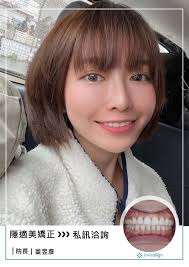 美德美學牙醫診所- 美德美學隱適美限時年末倒數方案⏲ 現在就Go 擁有全台最多使用者數據的隱適美👑 現在還有輕巧但同樣專業的#