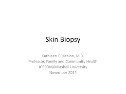 Shave biopsy biopsy of a skin lesion in which the sample is excised using a cut parallel to the surface of the surrounding skin. 7 Skin Biopsy Track