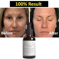 Image result for Tranexamic Acid