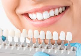 The Top 10 Benefits of Same Day Crowns