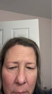 Recommend a cosmetic surgeon for facial scarring near Jefferson Hills