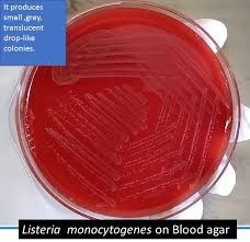 Listeria monocytogenes is one of the most common foodborne pathogens. Listeria On Blood Agar Introduction Morphology Culture Characteristics