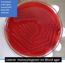 Listeria has been found in at least 42 species of wild and domesticated animals, and 17 species of birds. Listeria On Blood Agar Introduction Morphology Culture Characteristics