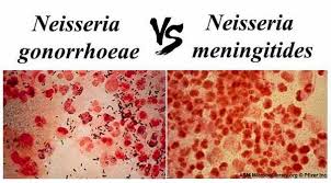 Image result for Neisseriaceae