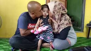 Rawatan jantung ini adalah ditanggung sepenuhnya oleh kerajaan negeri demi usaha membantu pesakit berkenaan merawat jantung dengan mengurangkan bebanan kos. Nurul Terima Subsidi Jalani Pembedahan Jantung Kali Kedua