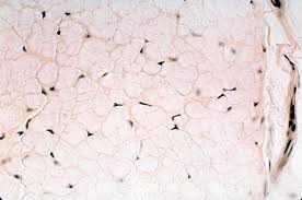 Are there macrophages in loose connective tissue? Connective Tissue Color Images