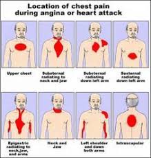 4 Bodily Signs A Heart Attack Is Near Nursing Care Cardiac Nursing Nursing Care Plan