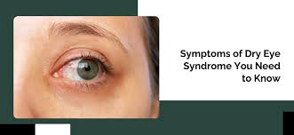 Image result for Dry Eye