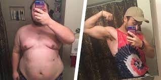 You will have general anesthesia before this surgery. Gastric Sleeve Weight Loss Surgery Helps Man Lose 170 Pounds In 8 Months