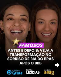 A apresentadora Beatriz Reis, conhecida como a Bia do Brás, passou por uma  transformação no visual. A ex-BBB renovou seu sorriso com lentes de  porcelana nos dentese o portal LeoDias te conta