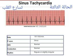 One design, the subcutaneous icd. Ø´Ø±Ø­ ØªØ®Ø·ÙŠØ· Ø§Ù„Ù‚Ù„Ø¨ Ø§Ù„ÙƒÙ‡Ø±Ø¨Ø§Ø¦ÙŠ Ecg ÙˆØªØ­Ø¯ÙŠØ¯ Ø§Ù„Ø­Ø§Ù„Ø© Ù…Ù† Ø±Ø³Ù… Ø§Ù„Ù‚Ù„Ø¨