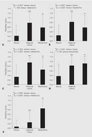 When a doctor performs a skin check, they look. Semiological Value Of Abcde Criteria In The Diagnosis Of Cutaneous Pigmented Tumors Semantic Scholar