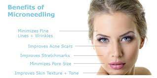 Microneedling In Palos Heights Il Zamara Medical Aesthetics Microneedling Skin Care Treatments Improve Skin Texture