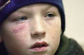 Schoolyard scuffle sends 10-year-old to hospital