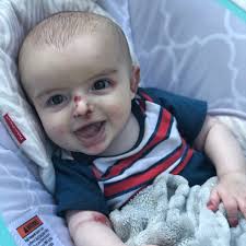 debra of America has teamed up with Maura Ambrose and friends to host the  Carson James Schiraldi Wound Care Supply Drive in loving memory of Maura's  godson, Carson.❤️🦋 This drive celebrates Carson's