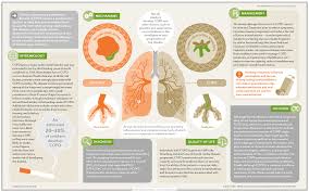 Chronic obstructive pulmonary disease phenotypes: Chronic Obstructive Pulmonary Disease Nature Reviews Disease Primers