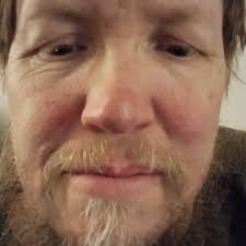 Has anyone gotten a rooster neutered in upstate New York or Vermont?