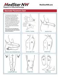 tens electrode placement chart pdf bedowntowndaytona com