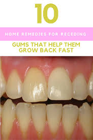 Flossing and brushing is essential. 10 Home Remedies For Receding Gums That Help Them Grow Back Fast Gum Disease Remedies Receding Gums Gum Care