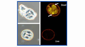 Image result for Cyclospora