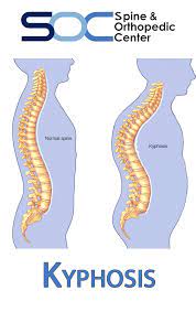 Pin On Orthopedic Education Diagnosis Treatment Florida