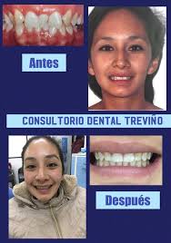 Consultorio Dental Treviño