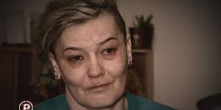 Djevojčica koju je brutalno pretukao otac: "Svi postupaju sa mnom kao da  ništa ne razumijem. A ja sve znam, ja sam to proživjela"