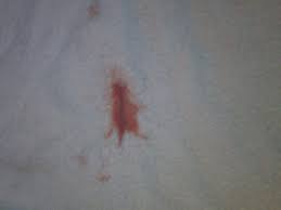 Pink discharge when i wipe. Period Tmi With Pic Please Help Glow Community