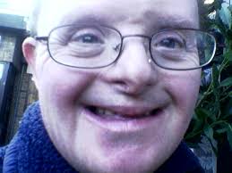 Downs Side Up: We have Down's Syndrome