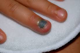 บริษัท โสภณ เคเบิ้ล ที.วี.และสื่อสาร พัทยา จำกัด, ชลบุรี. à¸›à¸£à¸°à¸• à¸«à¸™ à¸šà¸¡ à¸­à¸„à¸§à¸£à¸—à¸³à¸­à¸¢ à¸²à¸‡à¹„à¸£ à¸§ à¸˜ à¸£ à¸à¸©à¸²à¸›à¸£à¸°à¸• à¸«à¸™ à¸šà¸™ à¸§