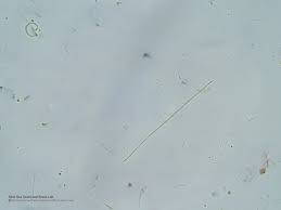 Image result for Raphidiocystis