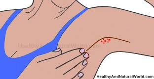 How to get rid of razor bumps on armpits. How To Get Rid Of Armpit Pimples Zits Or Pimple Like Bumps