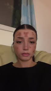 Understanding Mental Health Awareness and Support