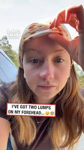 Can’t look away but kinda wanna 😬 #fblifestyle #health #shock