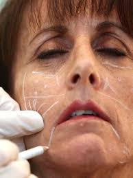 Botox at the mall: Medical spas growing in popularity