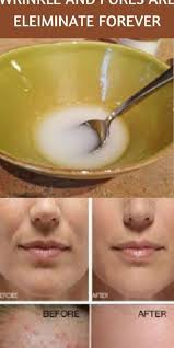 Just In 3 Use Of This Mask All Wrinkles Will Disappear From Your Face And Clear Skin Clearskinface Health Vicks Vaporub Skin