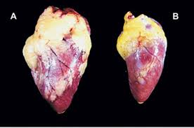 Scielo Brasil Evolution And Pathology In Chagas Disease A Review Evolution And Pathology In Chagas Disease A Review
