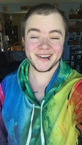 Hii I'm a trans woman and I want to get the surgery do you think my doctor  will make me get off the hormones I take daily before the surgery.