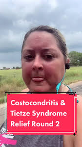 Natural Relief for Costochondritis and Tietze Syndrome