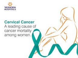 The signs of cervical cancer that will help you detect the disease as early as possible. Cervical Cancer A Leading Cause Of Cancer Mortality Among Women