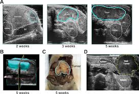 The most common, pancreatic adenocarcinoma, accounts for about 90% of cases, and the term pancreatic cancer is sometimes used to refe. Ultrasound Guided Orthotopic Implantation Of Murine Pancreatic Ductal Adenocarcinoma Protocol Translated To German