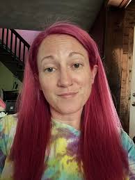 Sunburn update and weekend plans discussion