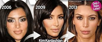 Kim kardashian let's start with kim. Kim Kardashian Before After Before After