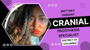 Cranial Prosthesis Directory