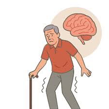 Image result for Ataxia