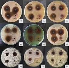 Probiotic Features of Three Lactic Acid Bacteria Strains Isolated from  Foods and Characterization of Their Bioactive Molecules