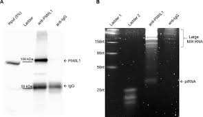 Was founded in 1887 as a general contractor. Identification Of Piwil1 Isoforms And Their Expression In Bovine Testes Oocytes And Early Embryos1