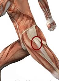 Hip Strength And Running Form Role Of Hip Drop In Running Injuries Running Injuries Running Form Running Workouts