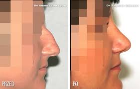 Jerzy Kolasiński (chirurgplastyk) — profil